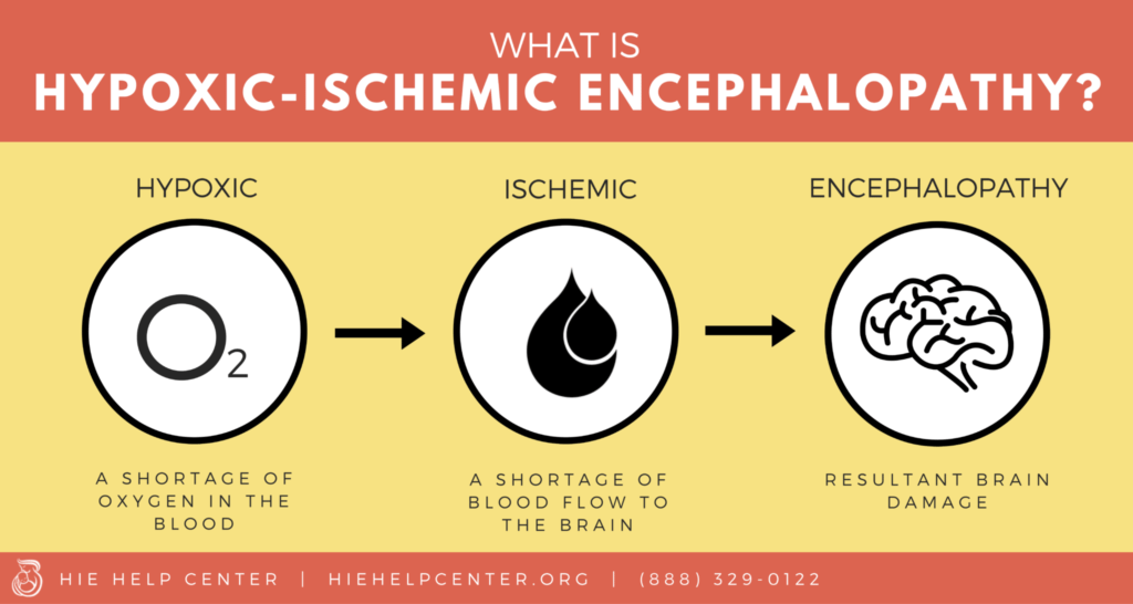 You are currently viewing Hypoxic Ischemic Encephalopathy: Causes, Symptoms, and Treatment