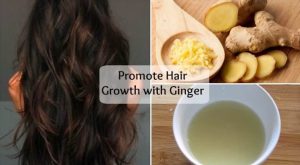 Read more about the article Ginger Benefits For Hair – How To Get Rid Of Dandruff Using Ginger