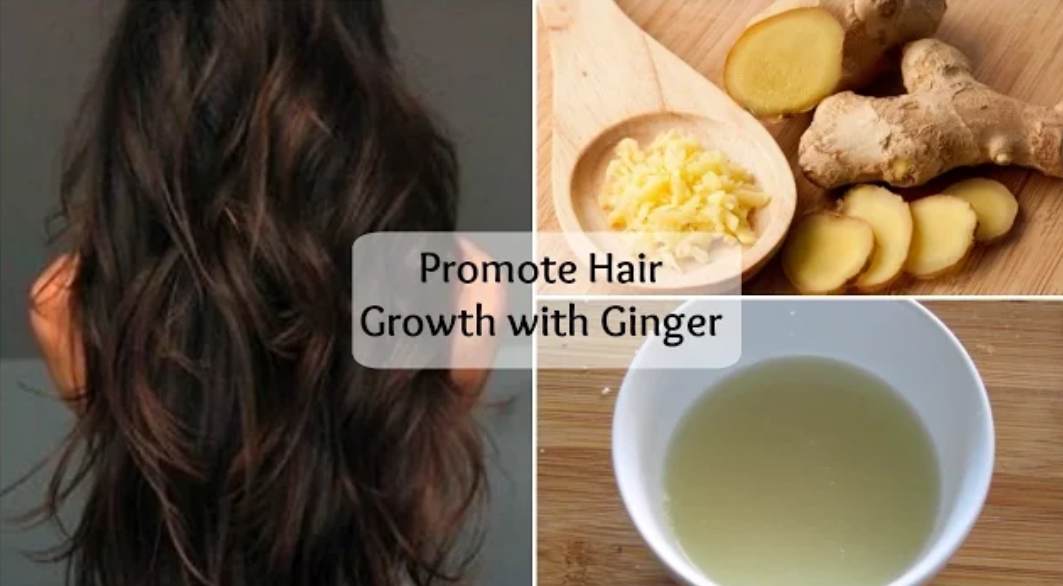 You are currently viewing Ginger Benefits For Hair – How To Get Rid Of Dandruff Using Ginger