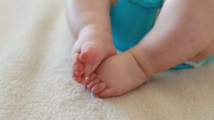 Read more about the article Lymphedema In Babies: Symptoms, Diagnosis and Treatment